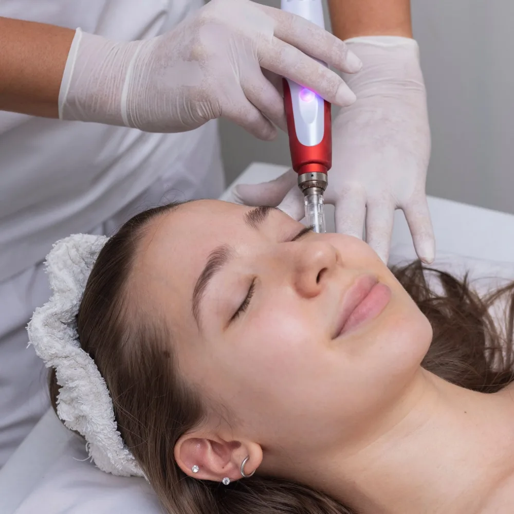 Jalupro Peel Glow + Mikronakłuwanie na twarz, szyję i dekolt by Luminexia